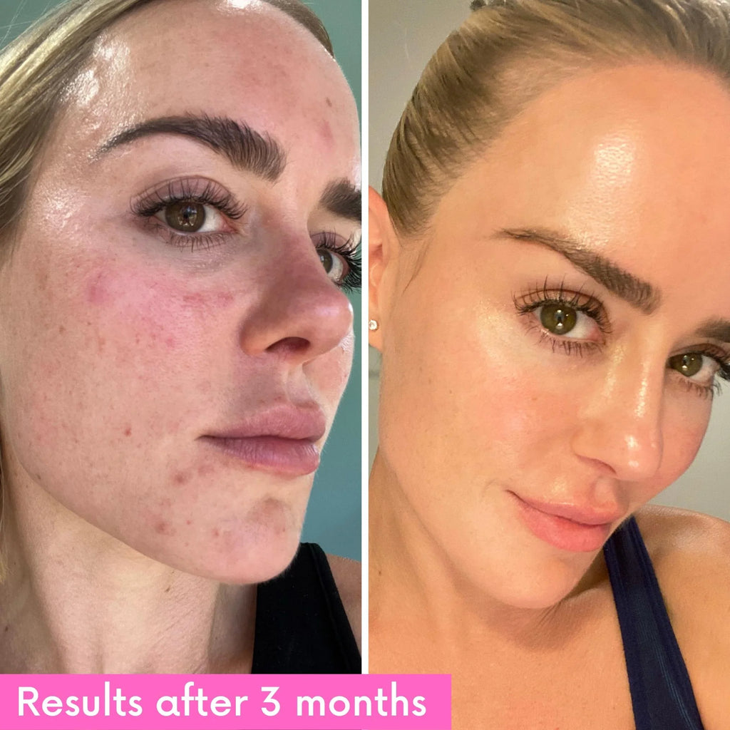 KOA LIFE Niacinamide Booster