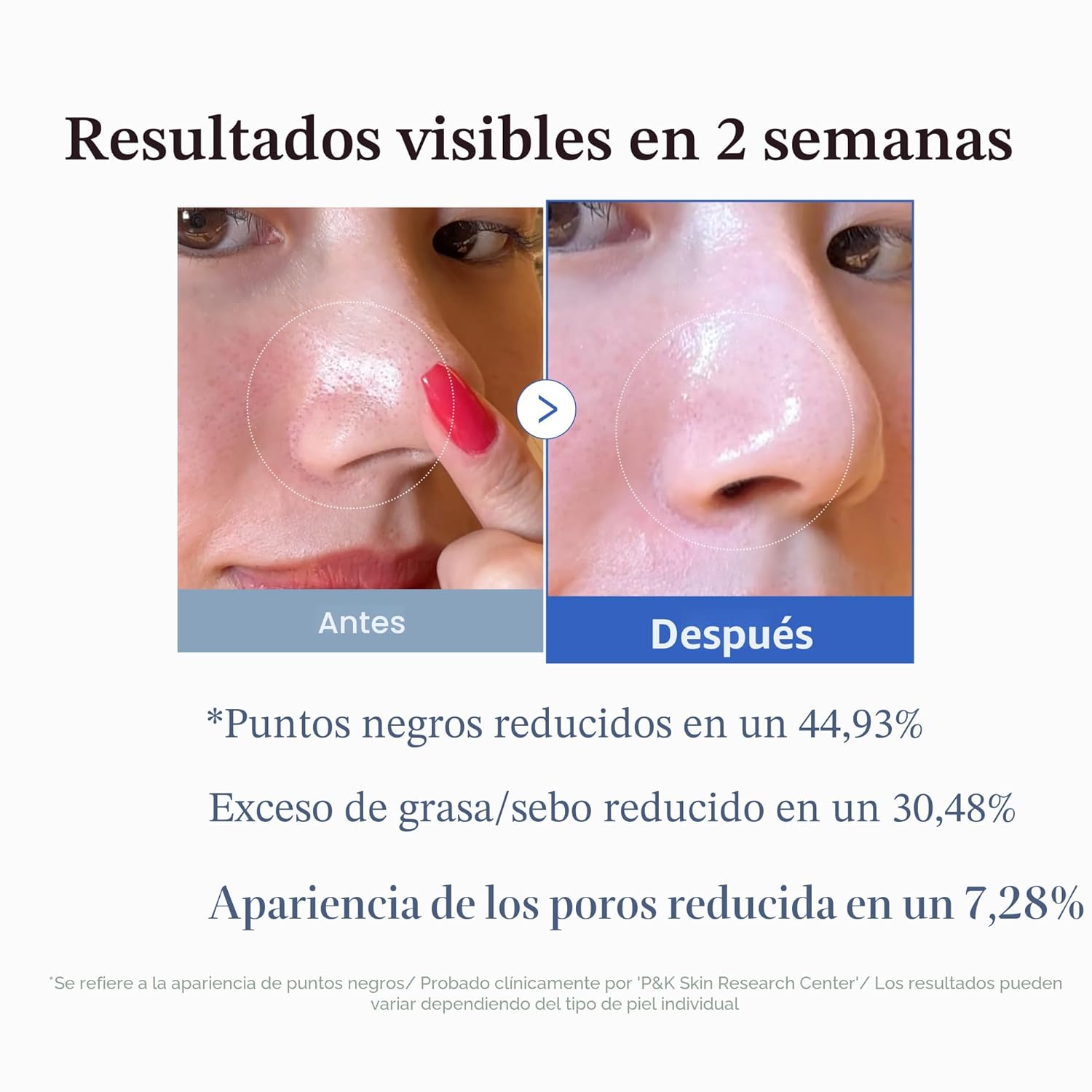 medicube - Zero Pore Pad 2.0 x 70 unidades