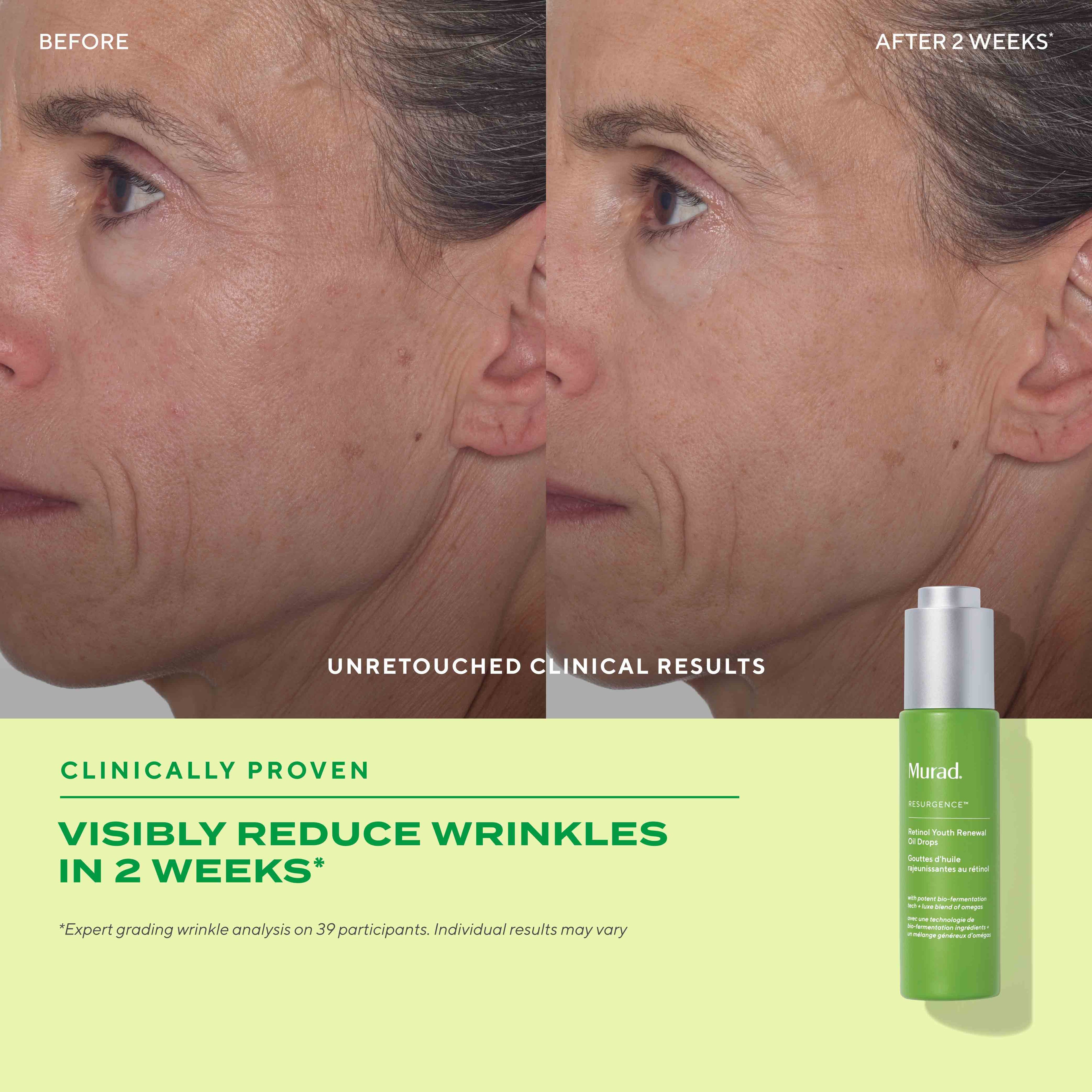 murad resurgence retinol renewal oil drops 30ml
