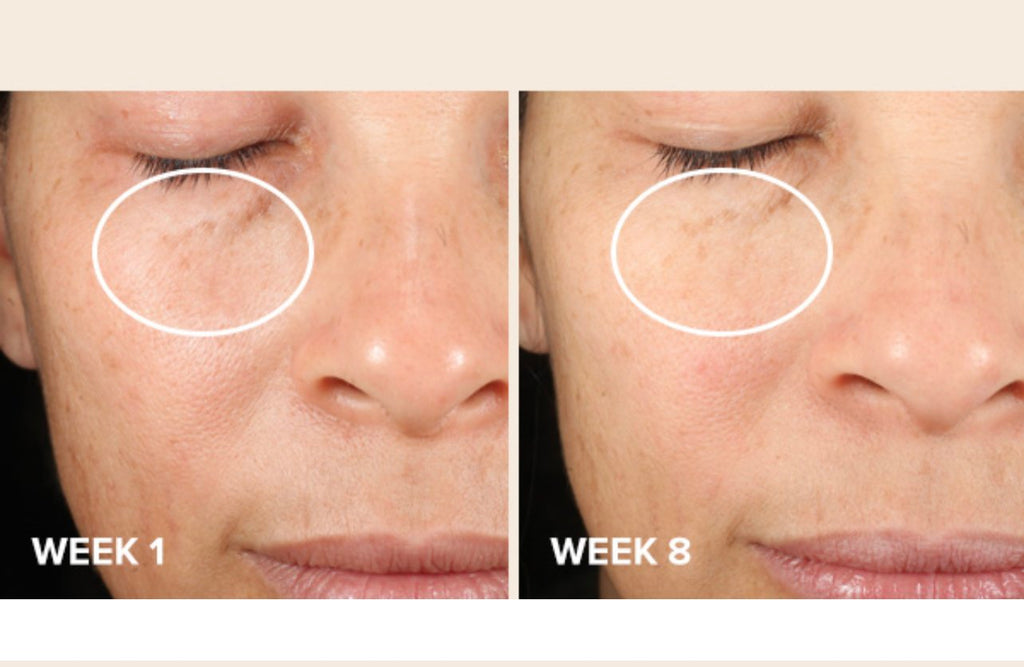 Paula's Choice CLINICAL Discoloration Repair Serum