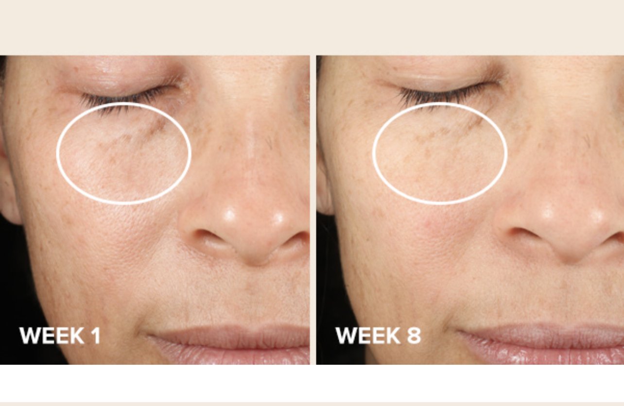 Paula's Choice CLINICAL Discoloration Repair Serum