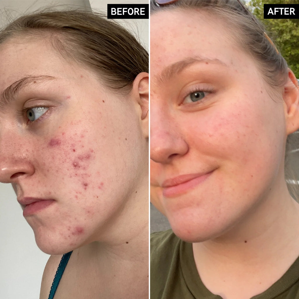 The Inkey List Glycolic Acid Toner (CAJA AVERIADA)