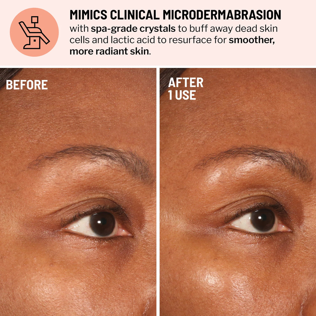 DR BRANDT Advanced Microdermabrasion Face Exfoliator