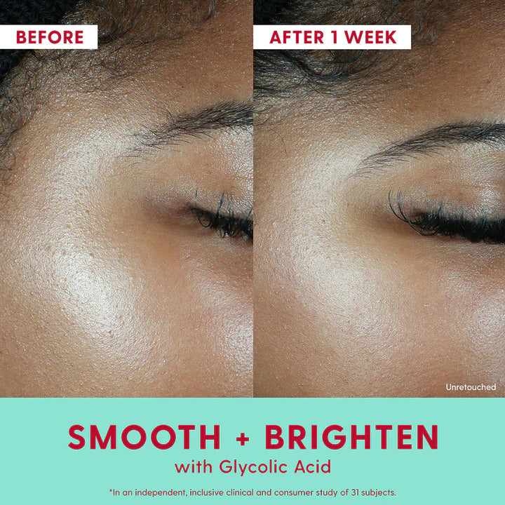 Kinship Self Smooth 10% Glycolic Resurfacing Serum