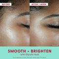 Kinship Self Smooth 10% Glycolic Resurfacing Serum