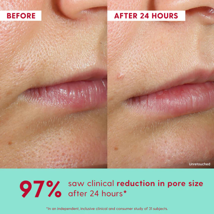 Kinship Self Smooth 10% Glycolic Resurfacing Serum