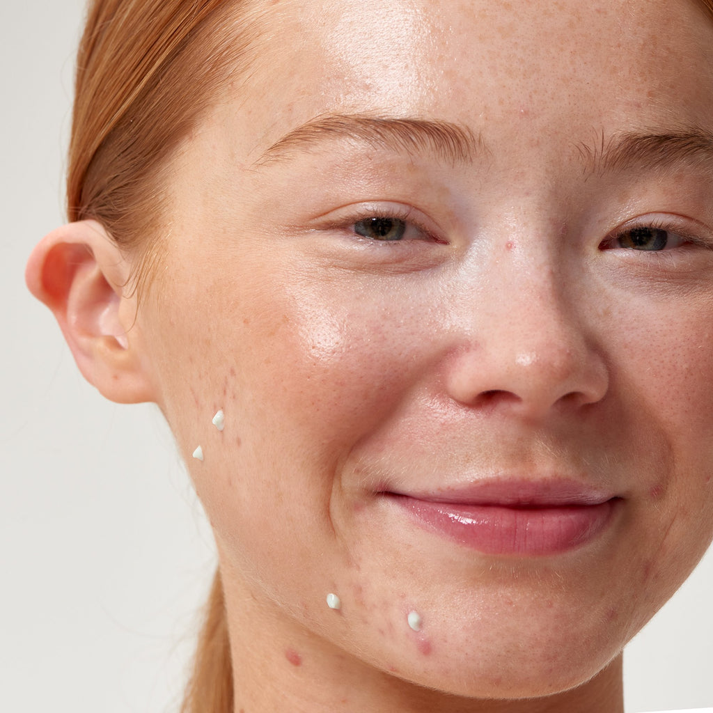 The INKEY List Succinic Acid Acne Treatment