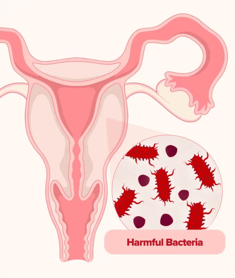 URO Vaginal Probiotic Capsules