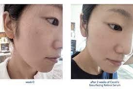 CeraVe Resurfacing Retinol Face Serum