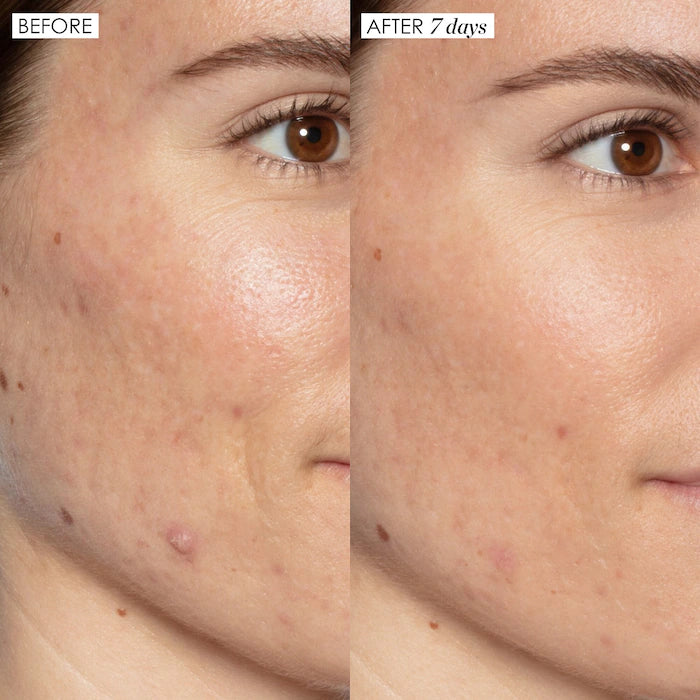 Sunday Riley Good Genes All-In-One AHA Lactic Acid Treatment