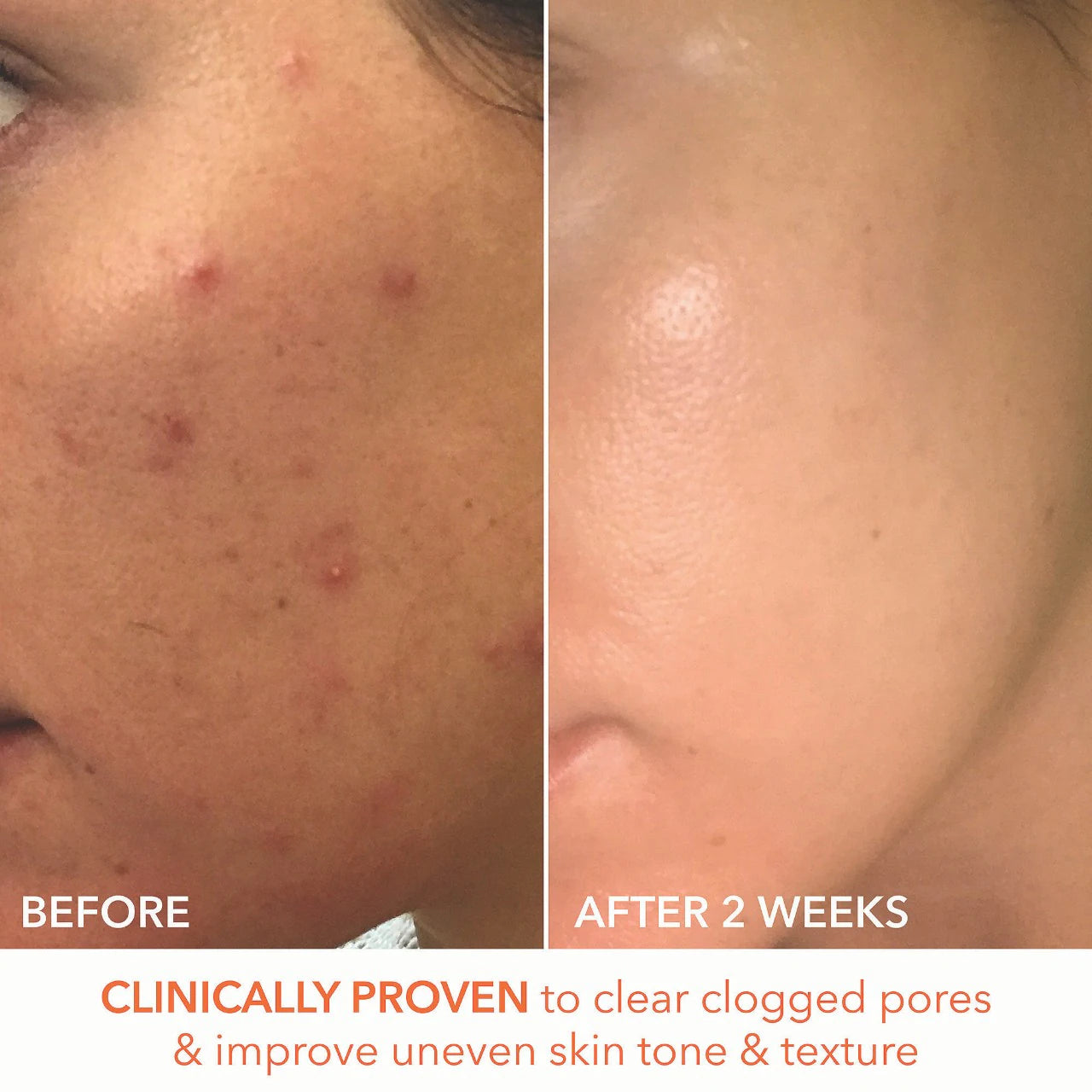 Dr. Dennis Gross Skincare  Mini Alpha Beta® Extra Strength Daily Peel Pads