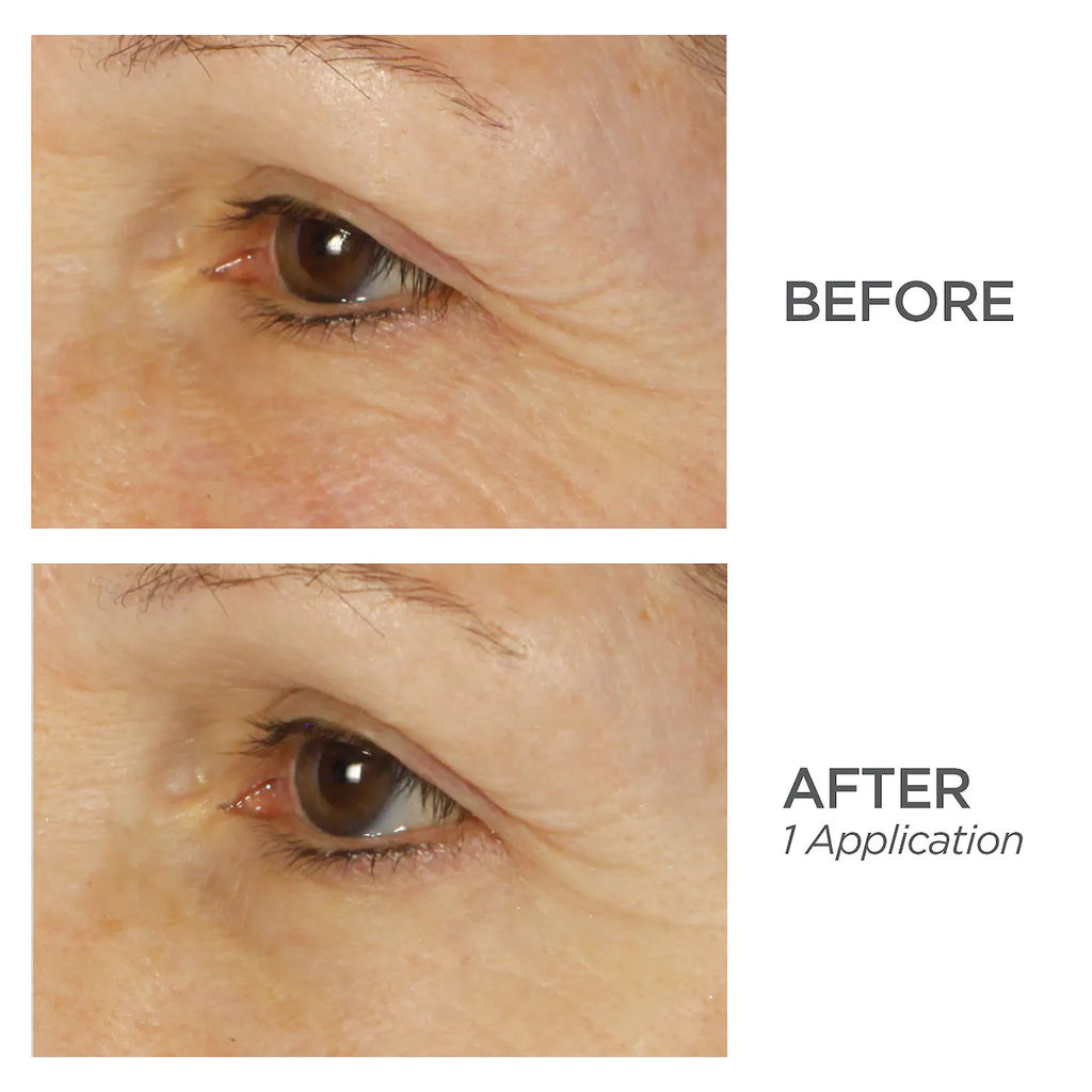 BeautyBio Bright Eyes Collagen-Infused Brightening Colloidal Silver Eye Masks