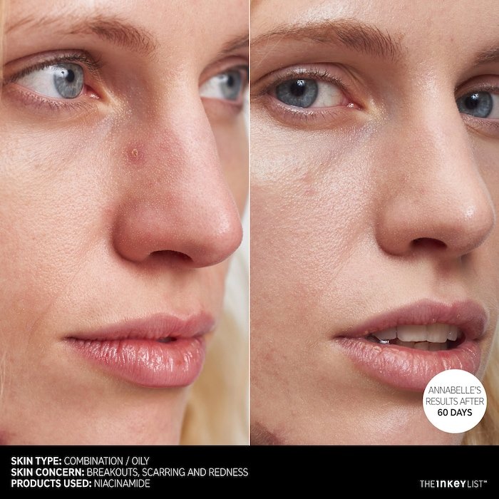 The INKEY List Niacinamide Oil Control Serum