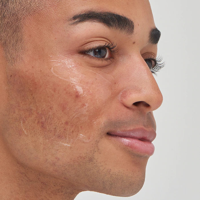 The INKEY List Tranexamic Acid Hyperpigmentation Treatment