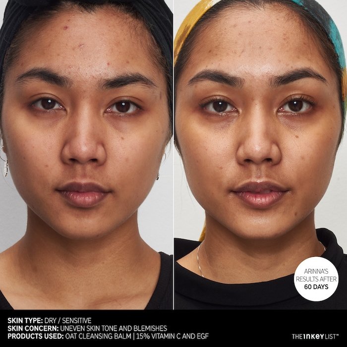 The INKEY List 15% Vitamin C and EGF Brightening Serum