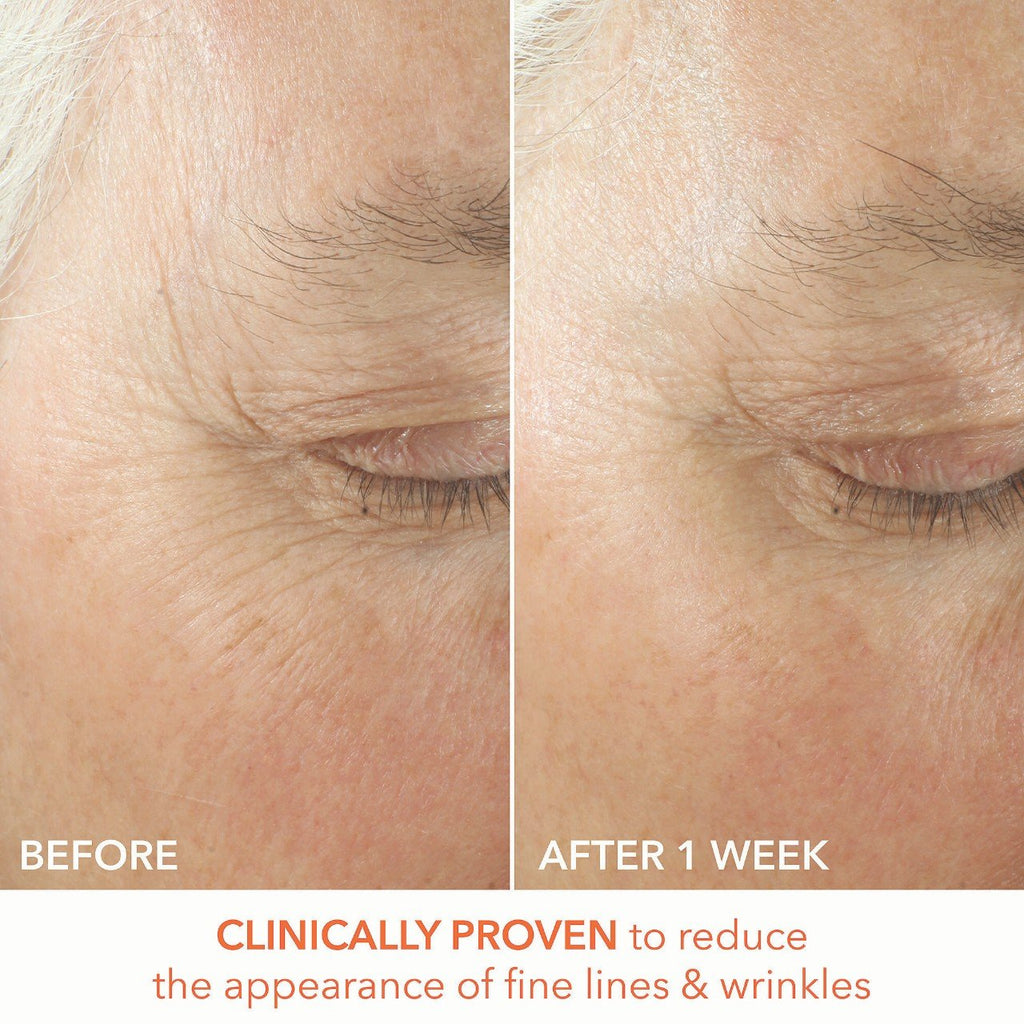 Dr. Dennis Gross Skincare Mini Alpha Beta® x 3