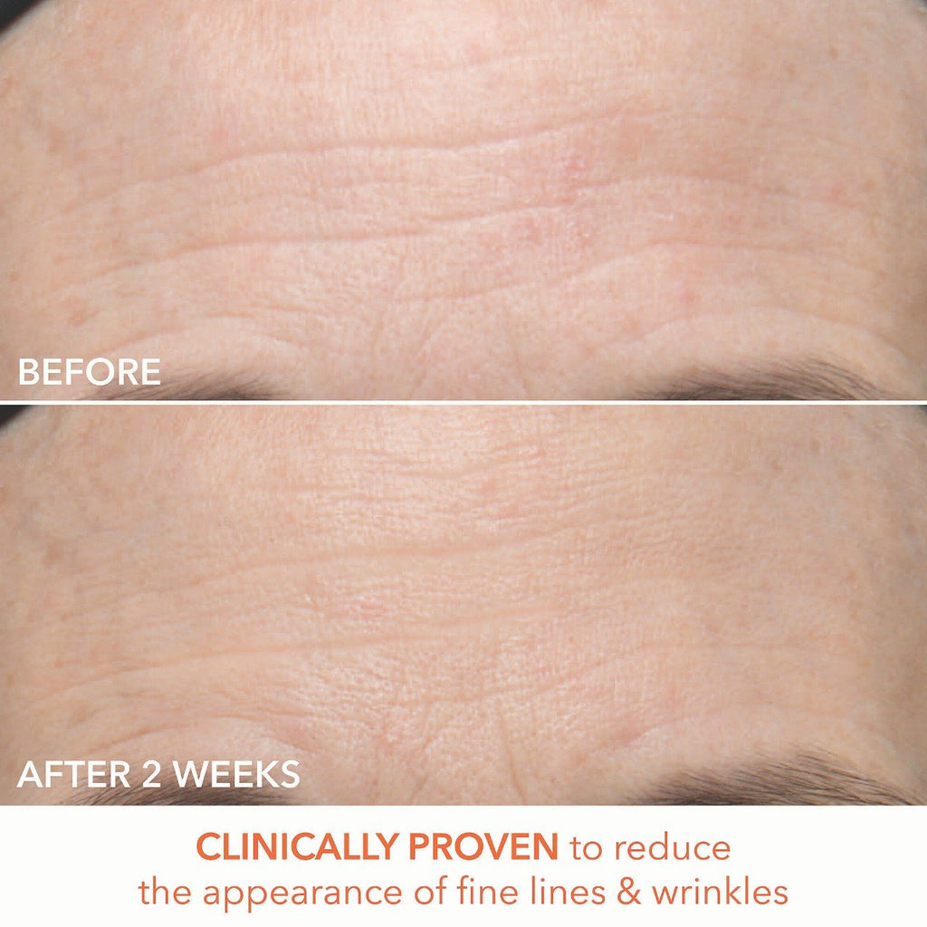 Dr. Dennis Gross Skincare Mini Alpha Beta® x 3