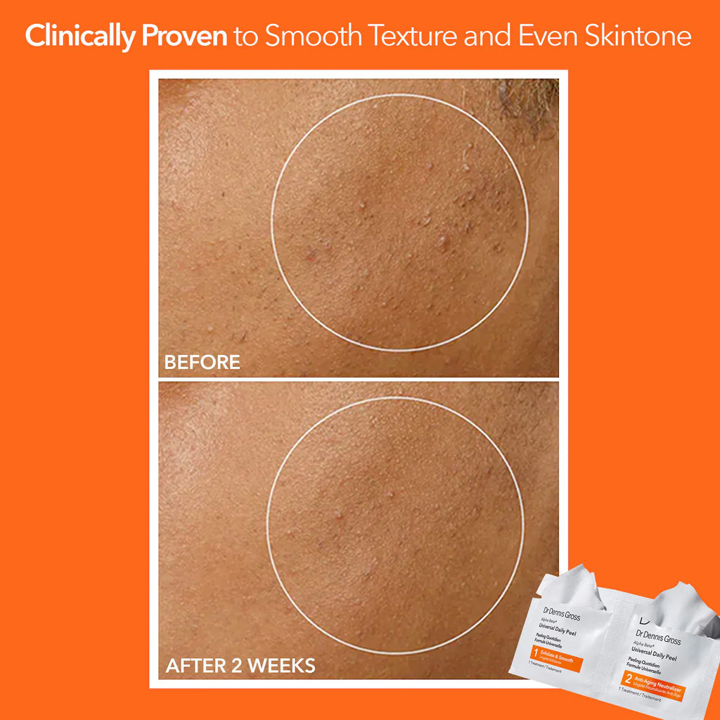 Dr. Dennis Gross Skincare  Mini Alpha Beta® Universal Daily Peel Pads 3 Treatments