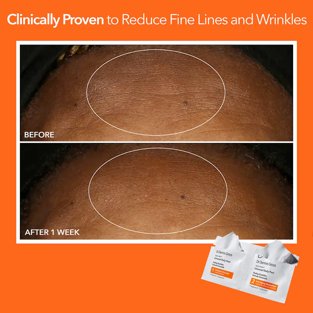 Dr. Dennis Gross Skincare  Mini Alpha Beta® Universal Daily Peel Pads 3 Treatments