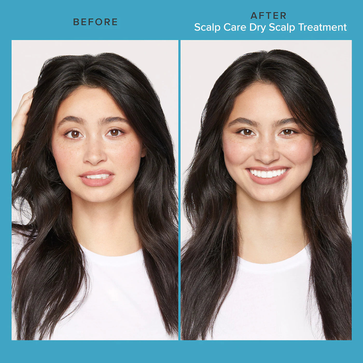 Living Proof  Scalp Care Dry Scalp Treatment