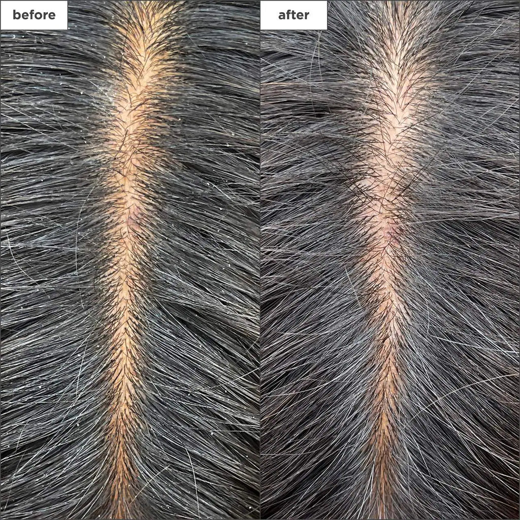 Briogeo  Scalp Revival™ Charcoal + Tea Tree Cooling Hydration Mask for Dry, Itchy Scalp 59ml