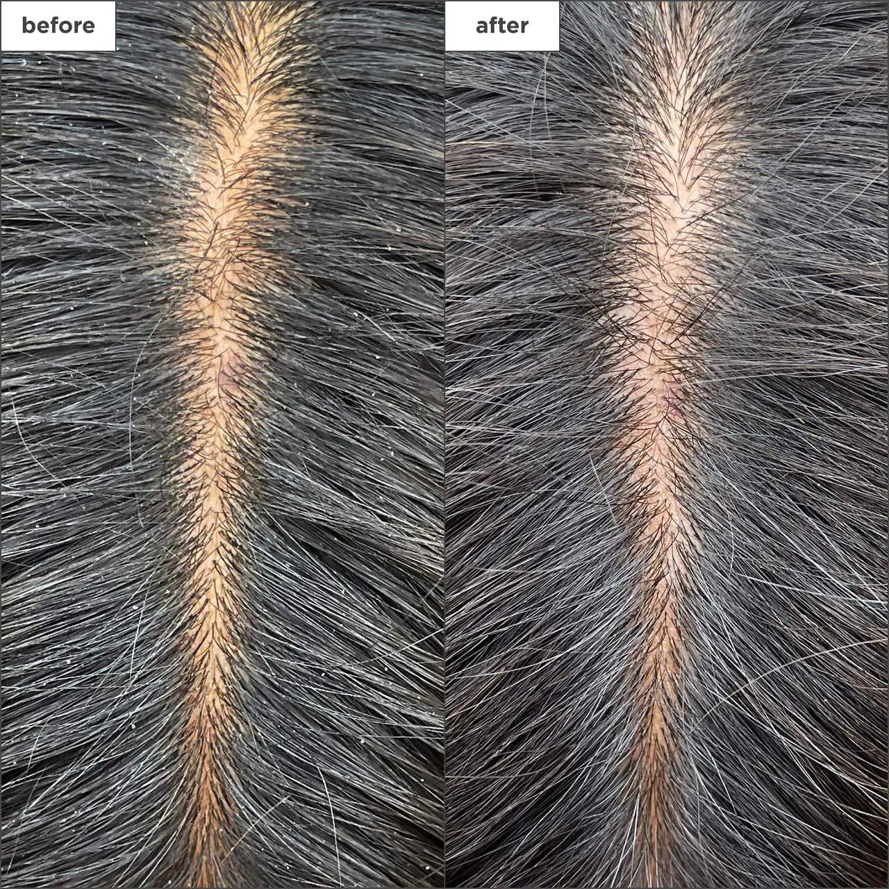 Briogeo  Scalp Revival™ Charcoal + Tea Tree Cooling Hydration Mask for Dry, Itchy Scalp 59ml
