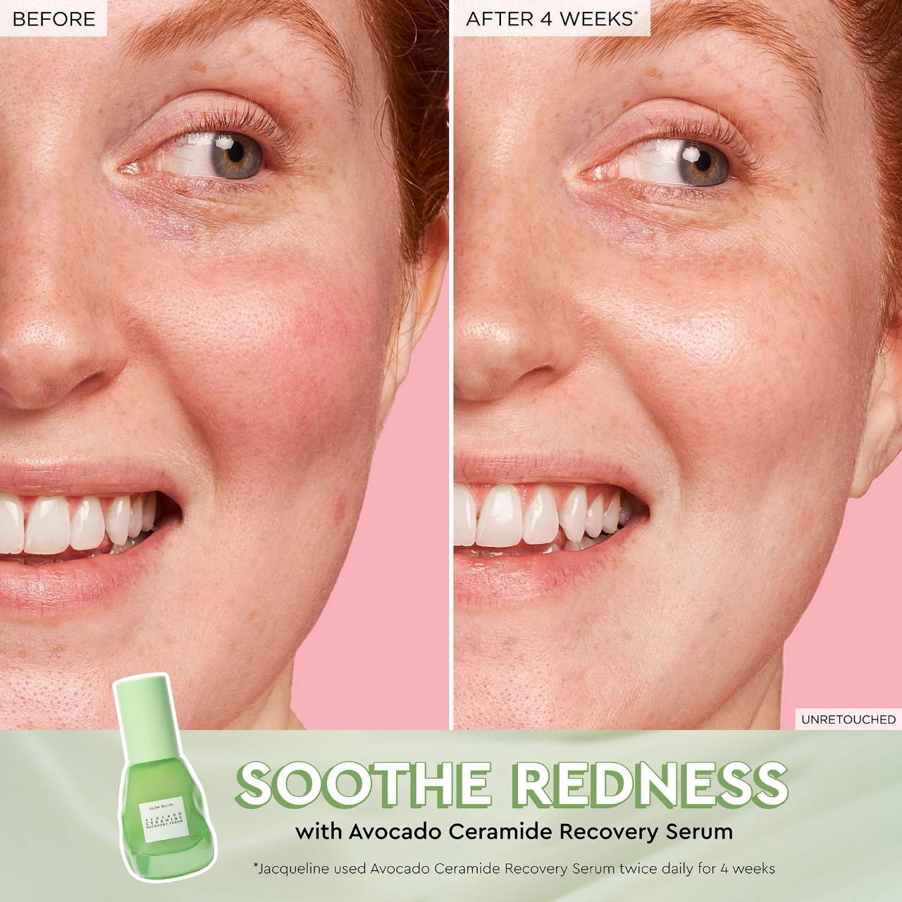 Glow Recipe  Avocado Soothing Skin Barrier Serum with Ceramides 30ML