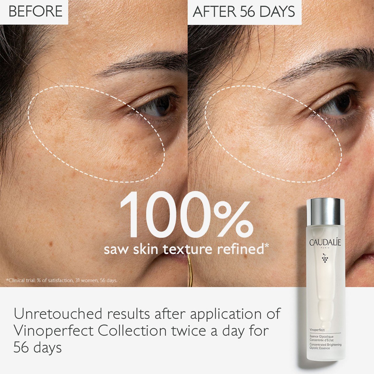 Caudalie Vinoperfect Concentrated Brightening Glycolic Essence 150ml