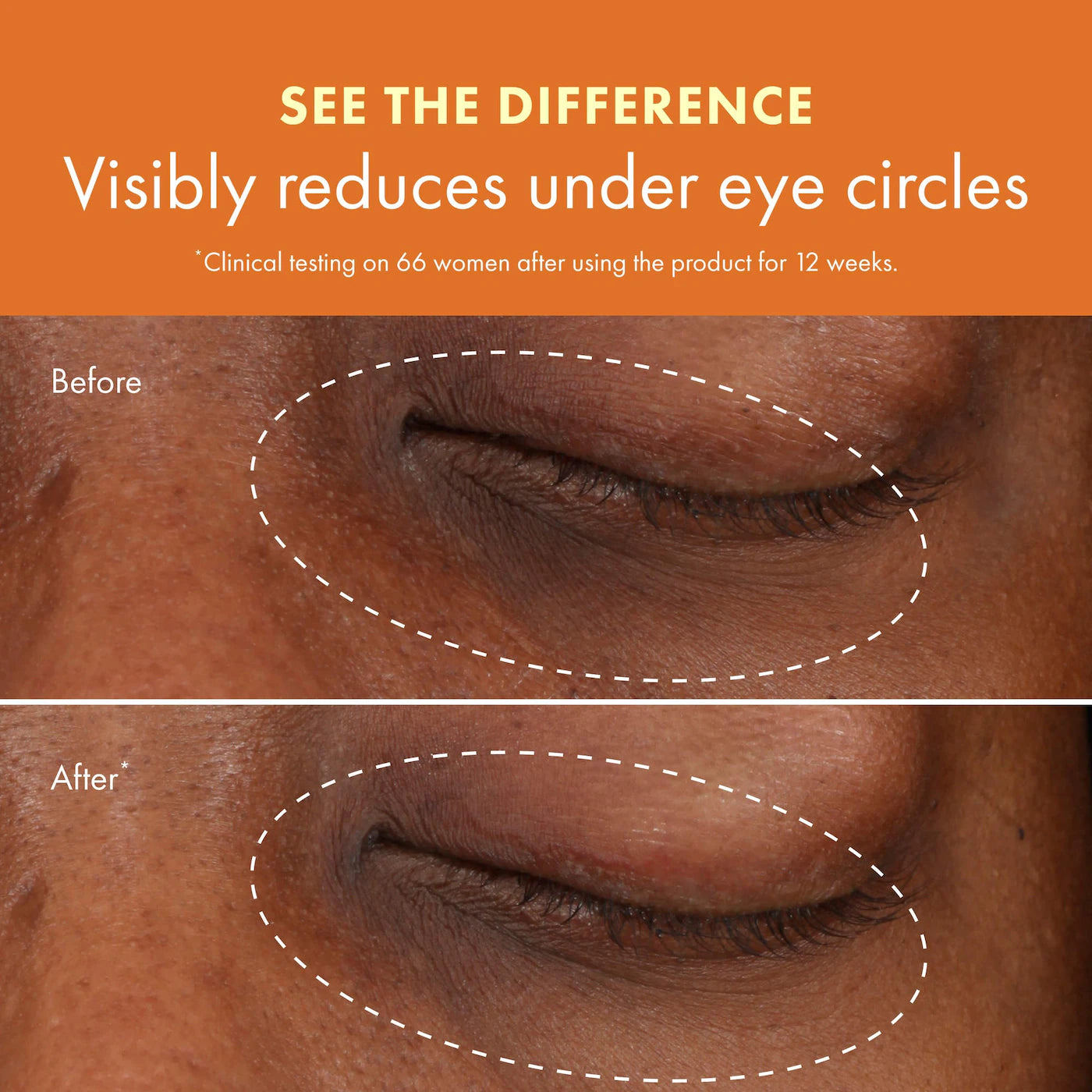 Origins  Ginzing™ Vitamin C Eye Cream to Brighten and Depuff (Original / Cool)