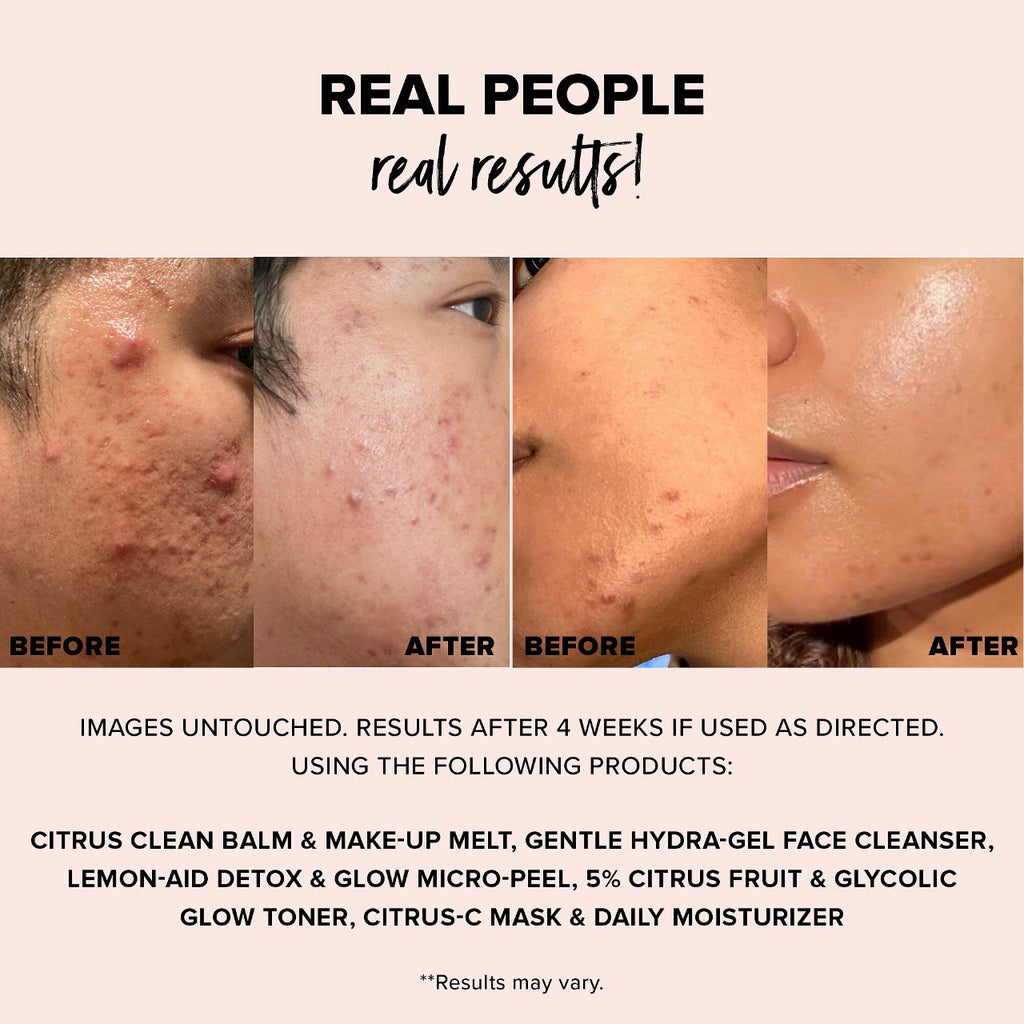 NUDESTIX NUDESKIN Citrus-C Mask & Daily Moisturizer