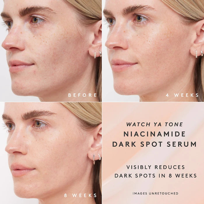 Fenty Skin Watch Ya Tone 5% Niacinamide Dark Spot Serum with Vitamin C