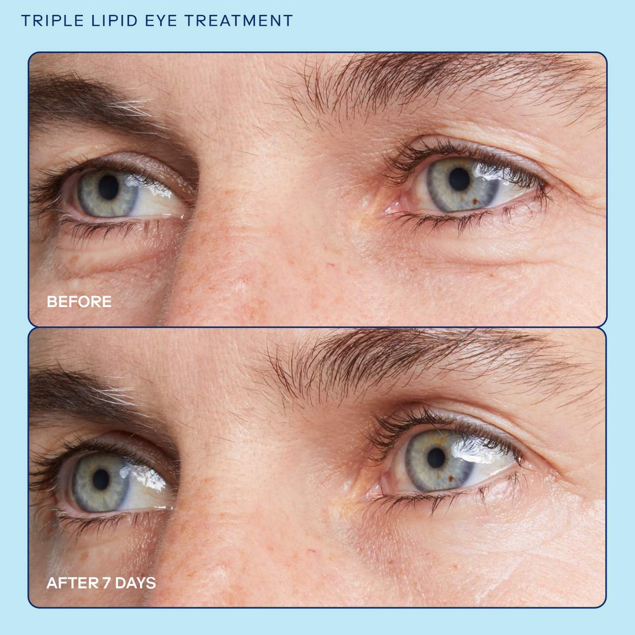 Skinfix  barrier+ Triple Lipid Brightening Eye Cream 15ML