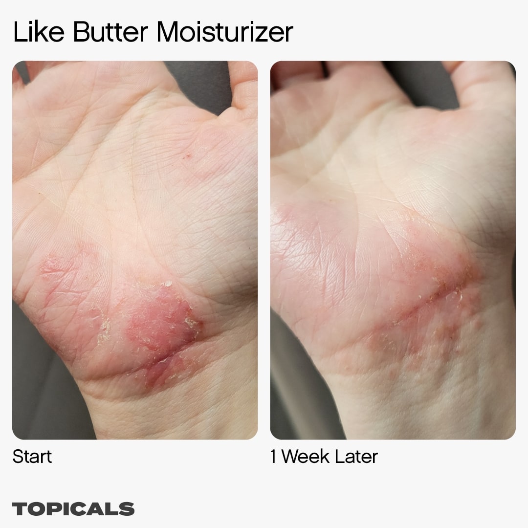 Topicals Like Butter Moisturizer for Dry, Sensitive & Eczema-Prone Skin