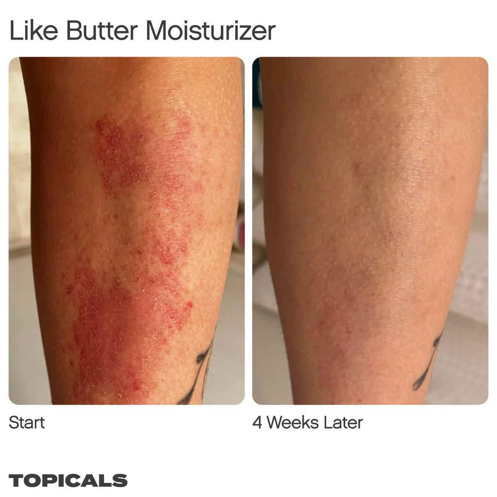 Topicals Like Butter Moisturizer for Dry, Sensitive & Eczema-Prone Skin