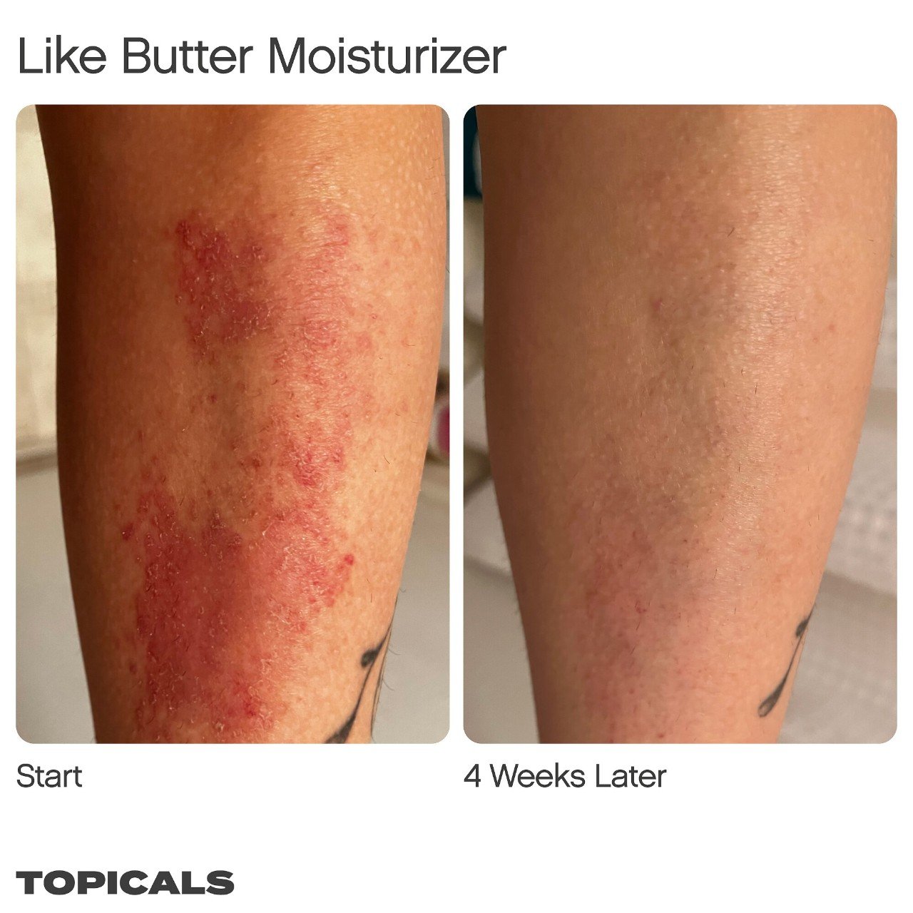 Topicals Like Butter Moisturizer for Dry, Sensitive & Eczema-Prone Skin