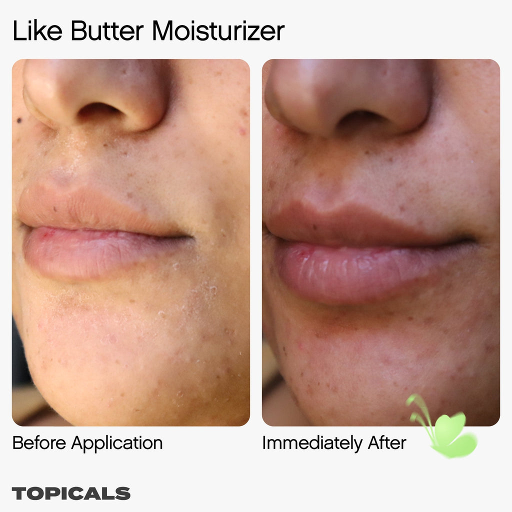Topicals Like Butter Moisturizer for Dry, Sensitive & Eczema-Prone Skin