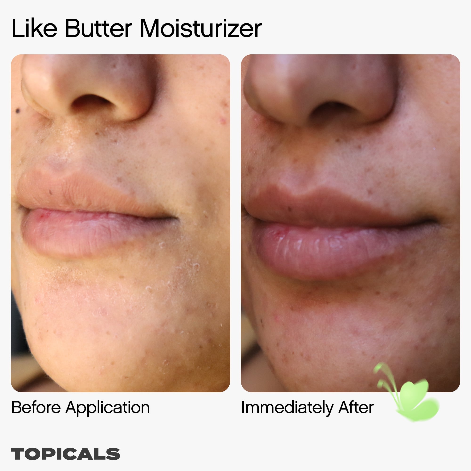 Topicals Like Butter Moisturizer for Dry, Sensitive & Eczema-Prone Skin