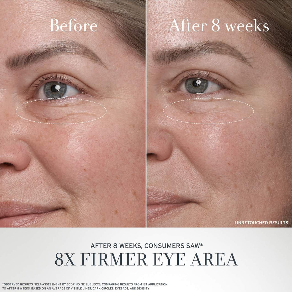 Fresh Black Tea Advanced Age Renewal Eye Cream  15ML