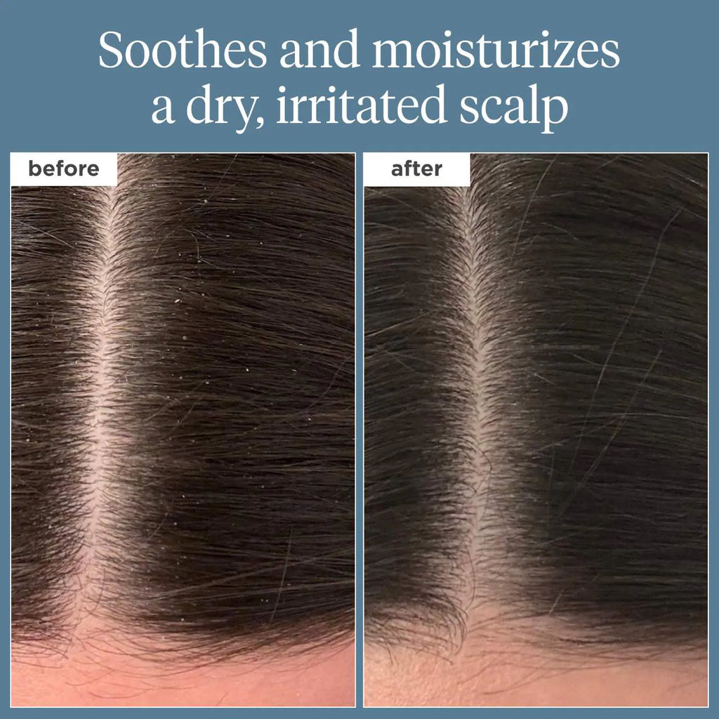 BRIOGEO HAIR CARE Scalp Revival™ Rosemary Pre-Wash Oil