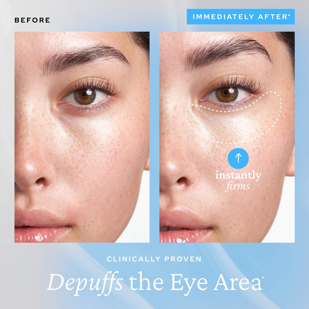 belif  Aqua Bomb Depuffing Eye Gel with Caffeine + Hyaluronic Acid 15ml