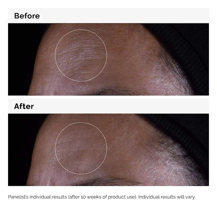 The Ordinary  GF 15% Serum for Visible Skin Repair and Wrinkles 30ml
