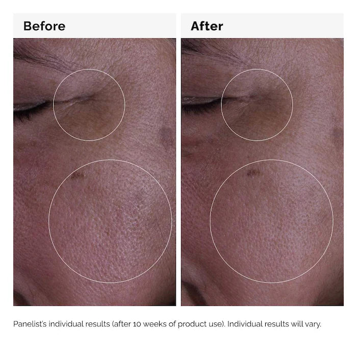 The Ordinary  GF 15% Serum for Visible Skin Repair and Wrinkles 30ml