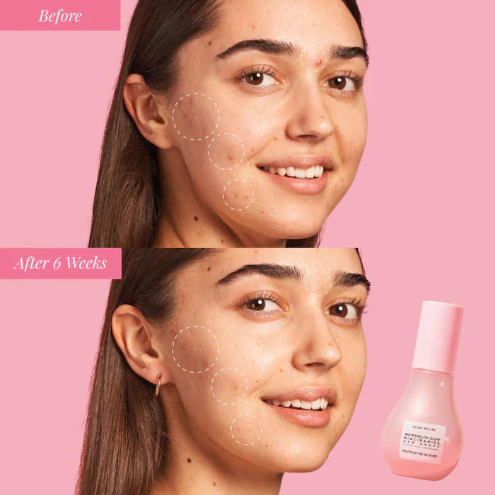 Sephora Favorites  The Glow Up Kit