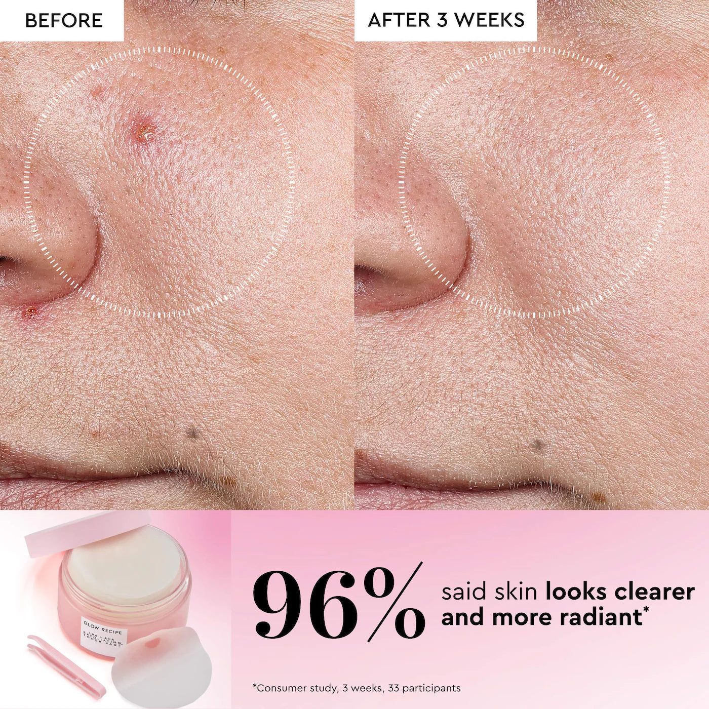Glow Recipe  LHA + AHA Korean Watermelon Toner Pads for Hydration and Gentle Exfoliation