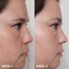 Paula's Choice Skin Perfecting 2% BHA Liquid Exfoliant - Imagen 3