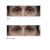 Tatcha AGELESS REVITALIZING EYE CREAM Revitalizing Eye Cream - Imagen 4