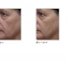 Tatcha AGELESS REVITALIZING EYE CREAM Revitalizing Eye Cream - Imagen 2