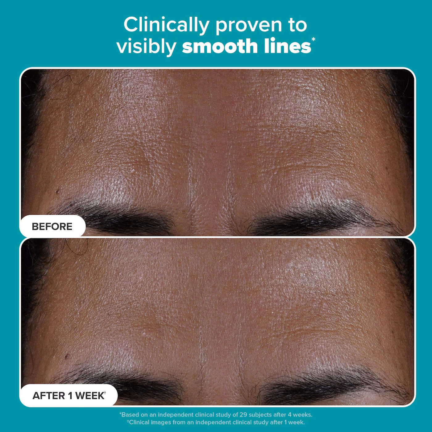 Paula's Choice Skin Perfecting 2% BHA Liquid Exfoliant - Imagen 9