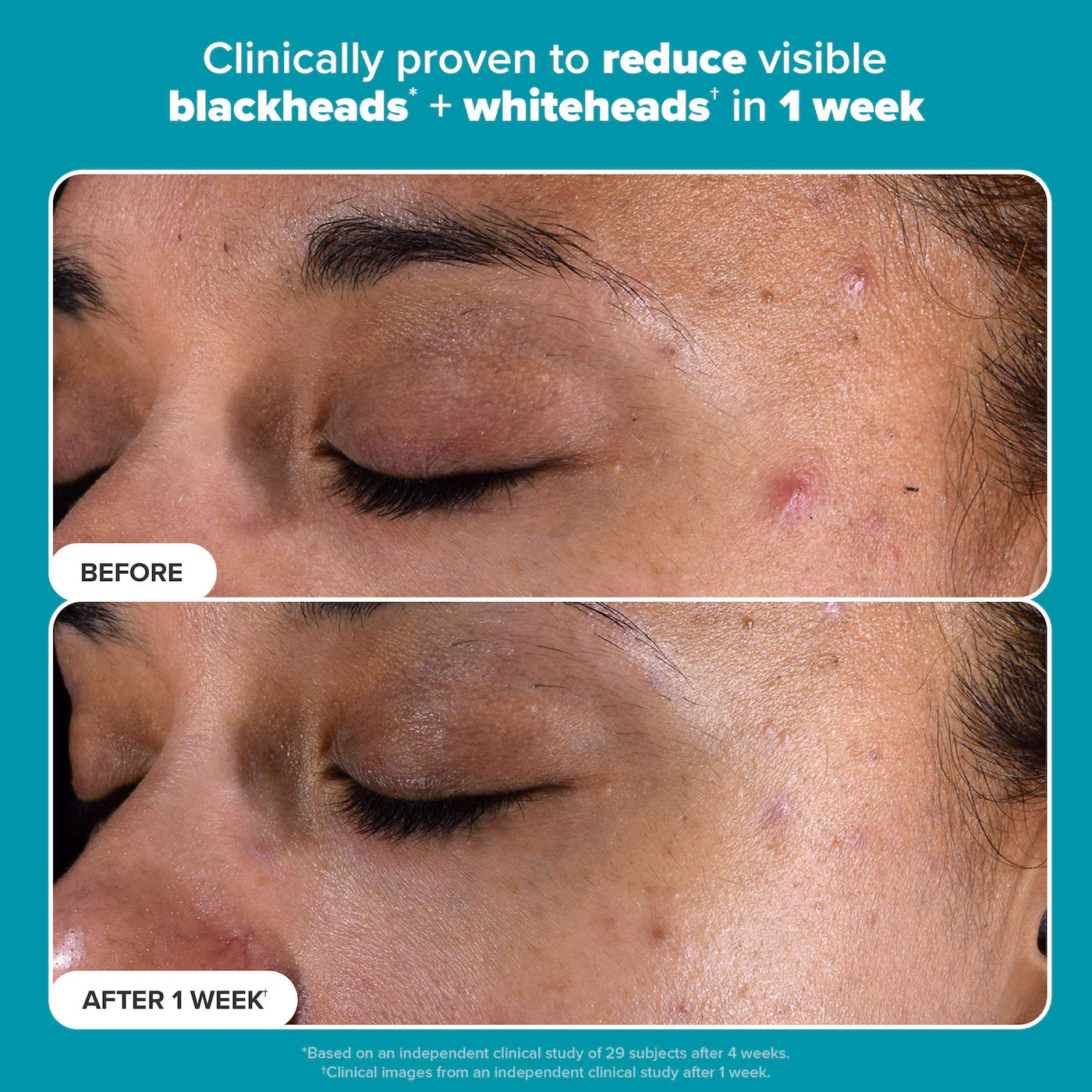 Paula's Choice Skin Perfecting 2% BHA Liquid Exfoliant - Imagen 8