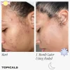 Topicals Faded Serum for Dark Spots & Discoloration - Imagen 4